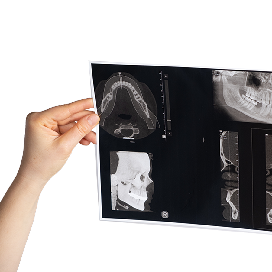 dental xray